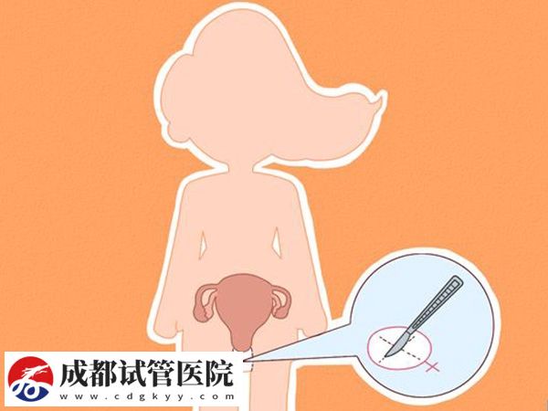 什么是始基子宮？始基子宮的治療方法有哪些？(圖5)